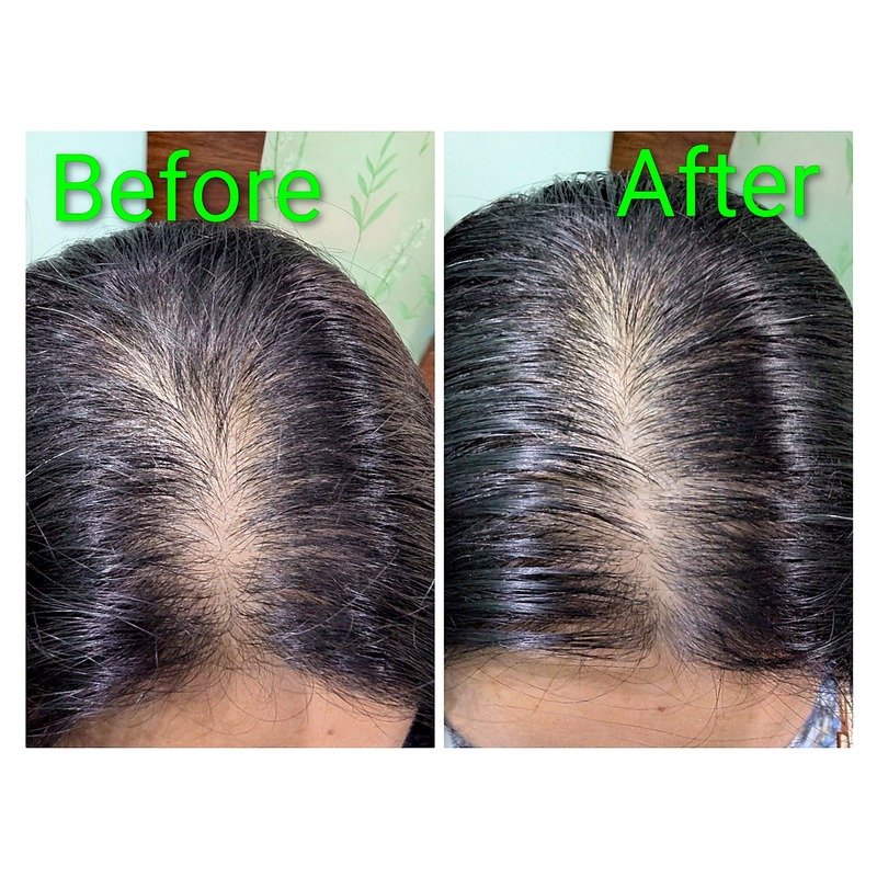 Before & After treatment result 3