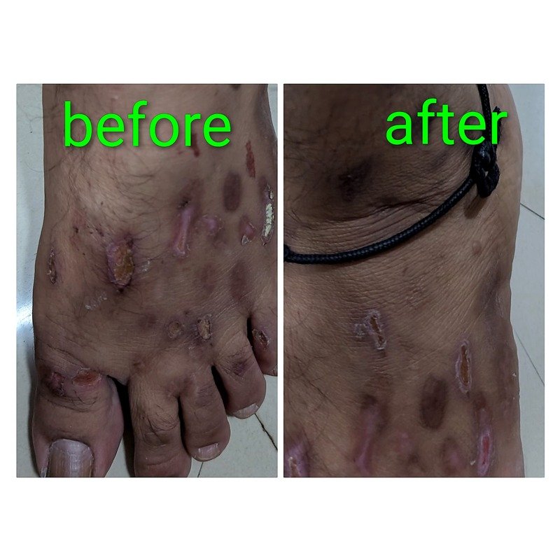 Before & After treatment result 4
