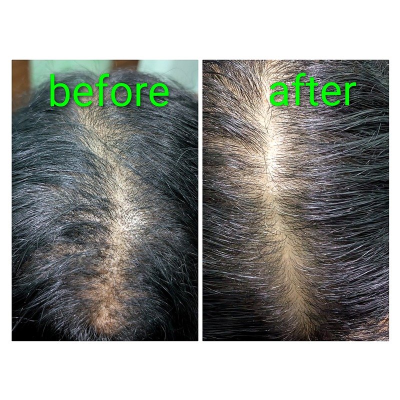 Before & After treatment result 5