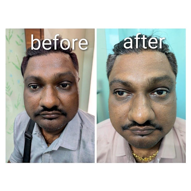 Before & After treatment result 7
