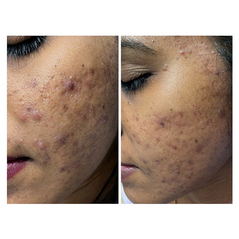 Before & After treatment result 8